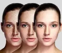 Slider image (3) Atempo Med Spa - Aesthetic Medicine in Mexico City